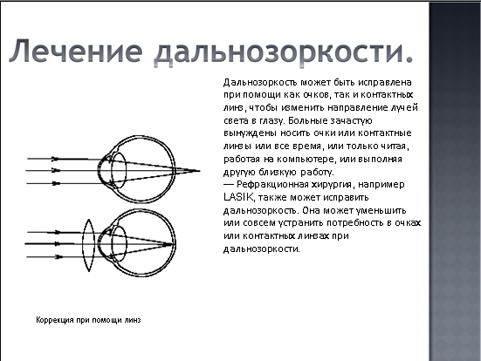 На каком из рисунков правильно показано исправление дальнозоркости